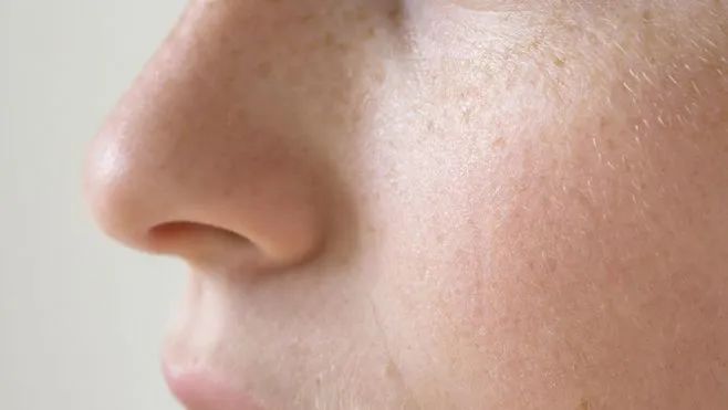 鑴告墦姘村厜閽堟湁鍓綔鐢ㄤ箞,鎵撴按鍏夐拡鍓綔鐢ㄦ湁鍝簺