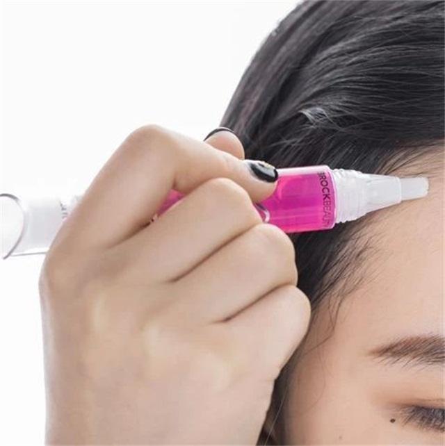 一招教你解决发际线后移,发际线秃了怎么拯救真实案例