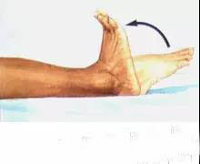 nba球员脚踝骨折恢复,nba篮球运动员脚踝撕脱性骨折