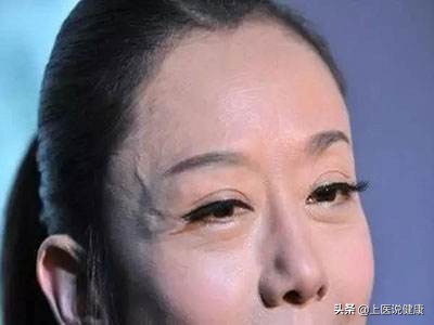 身体上出现的青筋是怎么回事,身体上的青筋明显是怎么回事