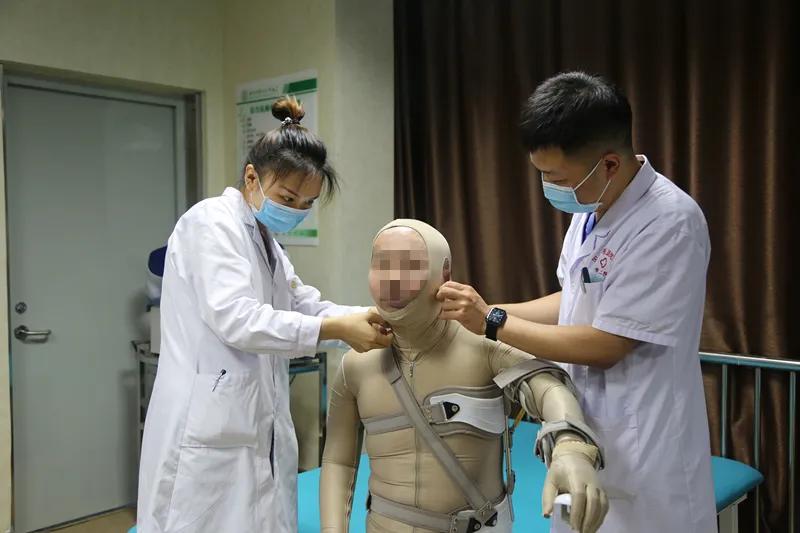 江苏省人民医院烧伤康复中心,医院烧伤康复患者