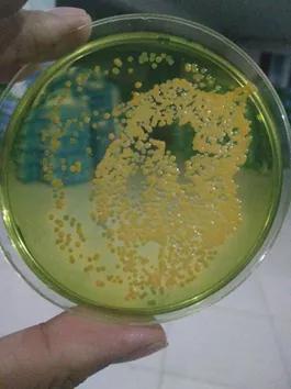 对虾黄鳃黑鳃是什么原因,对虾黄鳃防治