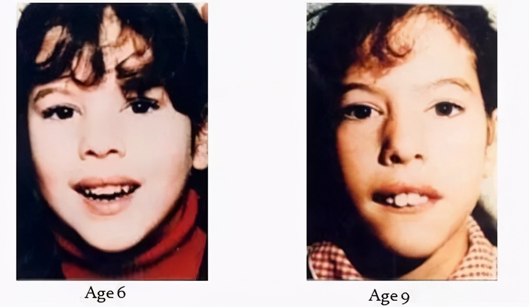 孩子张嘴呼吸如何纠正,孩子喜欢张嘴有什么影响