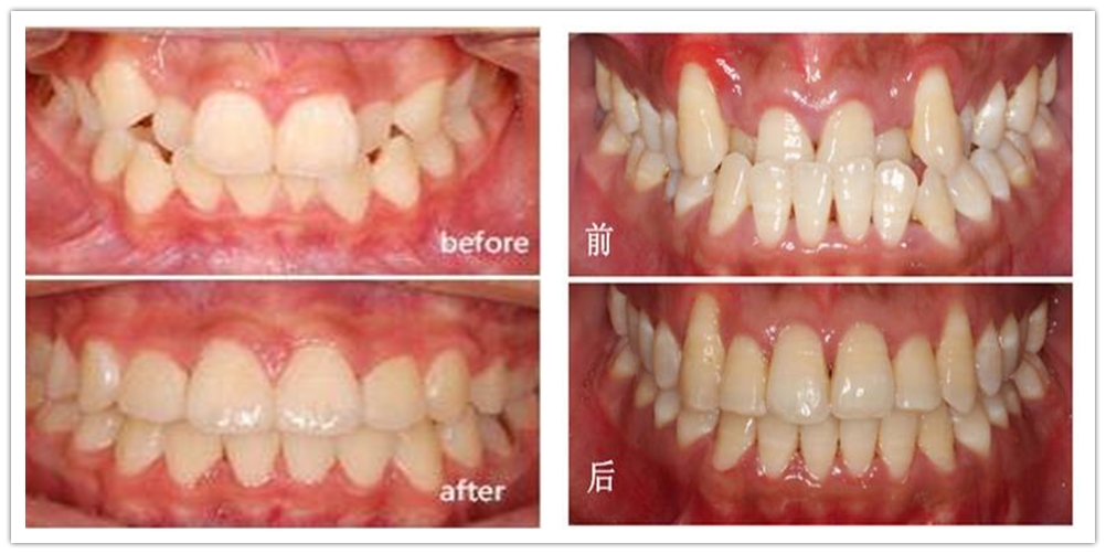 口腔科诊疗指南及技术操作常规,口腔科疾病的最新诊疗护理措施