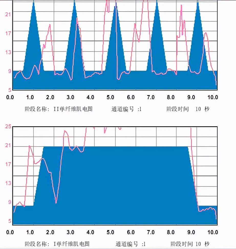 盆底肌训练游戏仪器,盆底肌修复游戏怎么玩