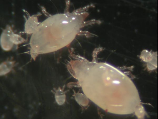 螨虫会导致背部泛红瘙痒,后背螨虫感染多长时间可以治愈