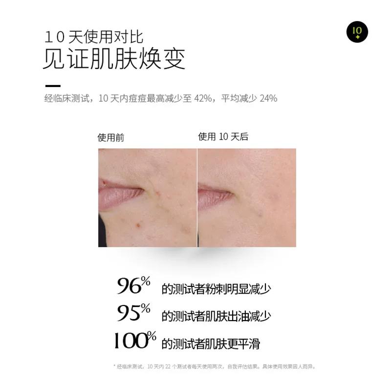 推荐一款好用的平价祛痘产品,非常好用的祛痘产品推荐一下