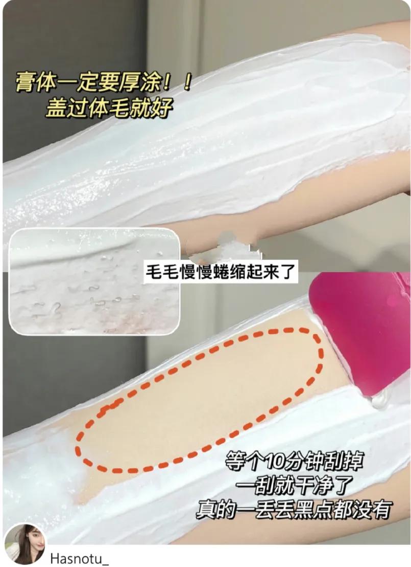 每个人的身上都有小毛毛,每个人的身上都有毛毛没有腿毛吗