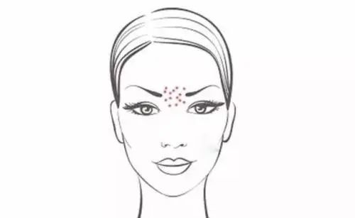 脸上老是长痘怎么祛痘,28岁了脸上老是长痘痘怎么办