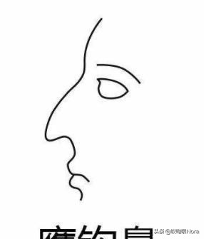 最自然的小翘鼻,鼻综合小翘鼻图片