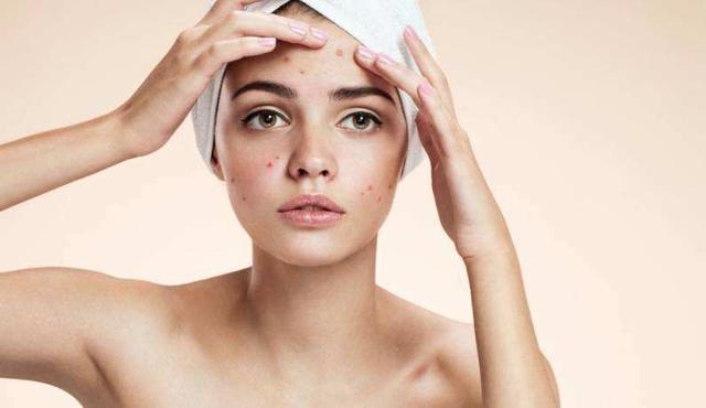 红霉素软膏涂脸会闷痘么,红霉素软膏涂在脸上会留疤吗