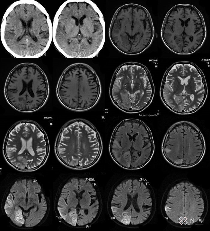 iseihealth:40岁以上的妇女至少应做的16项检查清单