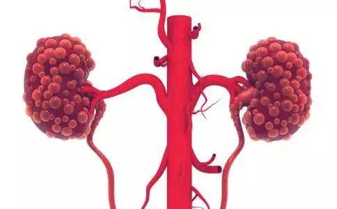 比香烟更容易致癌的食物有哪些 (比香烟致癌的食物)