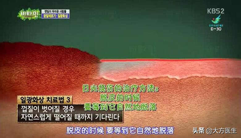 小孩皮肤晒伤后如何修复,晒伤的皮肤怎么修复小妙招