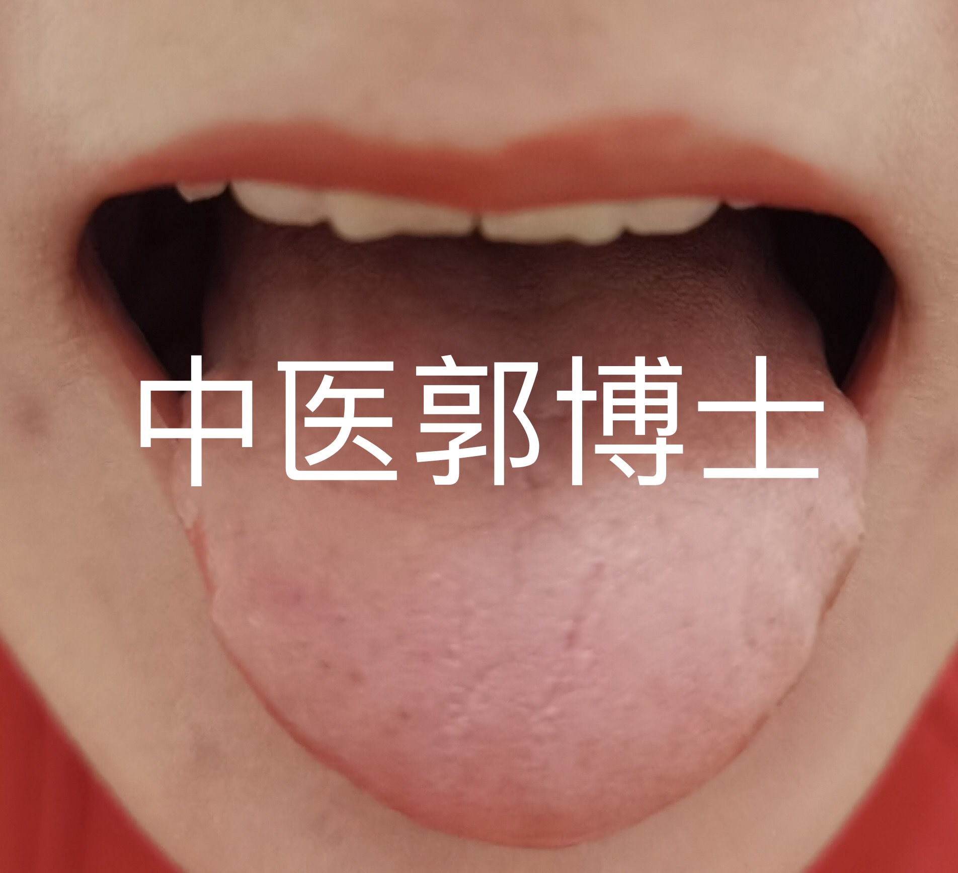 例假水多血少,例假血少时间长