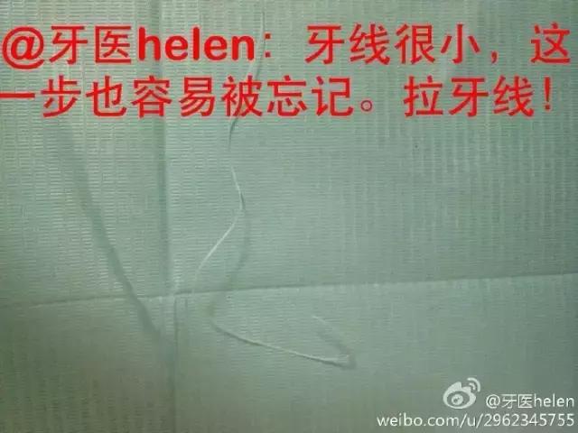 Helen齿科中心——超声波洁牙