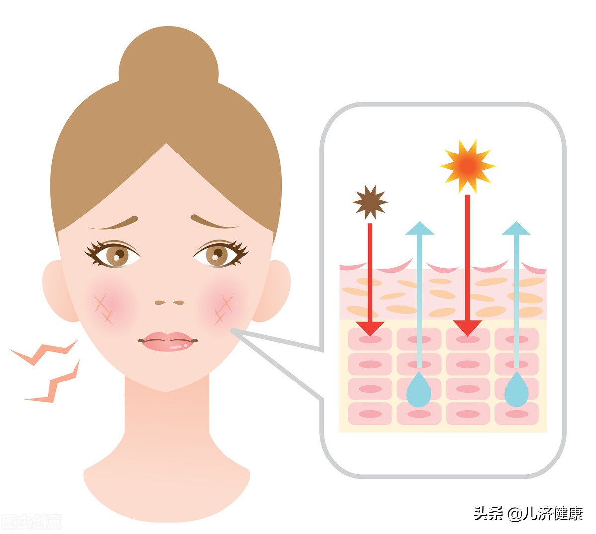 秋季皮肤起干皮怎么办,秋季皮肤干燥容易掉皮怎么回事