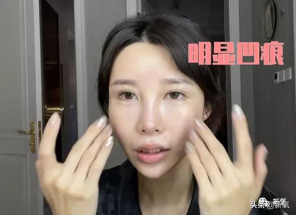 网红整鼻子整出坑,千万网红被坑
