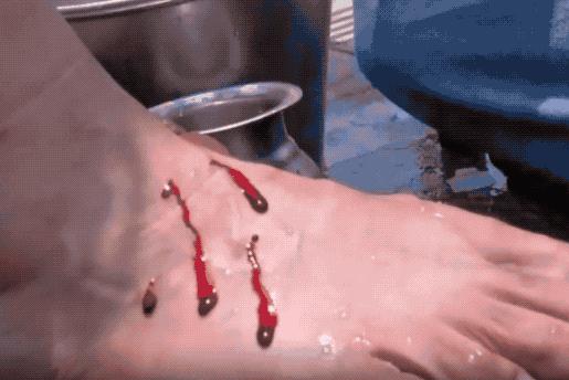 涓浗鍙や唬鍖诲鎵嬫湳,鍙や唬鍖诲鎵嬫湳