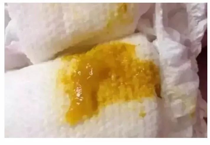 怎样判断新生儿宝宝大便是否正确,新生儿宝宝大便怎么判断是否正常