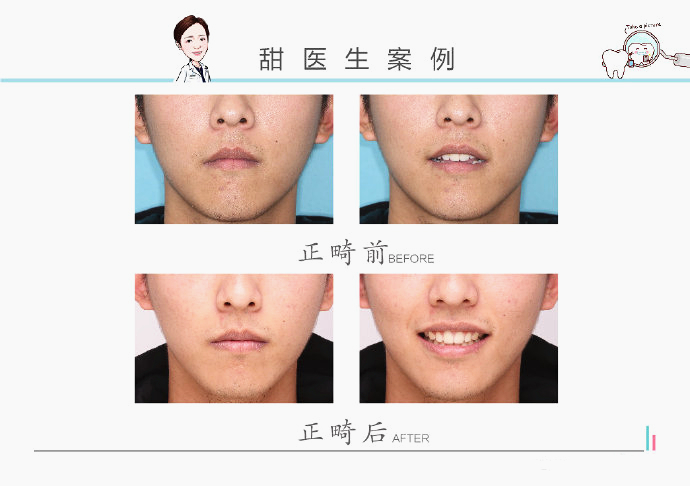 西安哪里有做牙齿矫正,在西安哪里可以做牙齿矫正