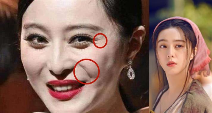 女子为变美花掉300余万后续,女子为变美脸塌陷