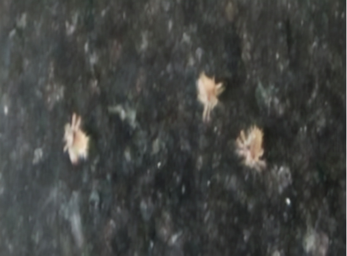 阴虱是什么？洁身自好的人为什么会得阴虱？一般有2个传播途径