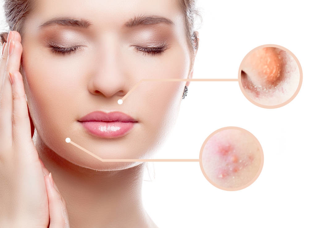 痘疮病主要危害,痤疮会自卑吗