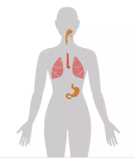 四个早期症状告诉你得了癌症,四种情况你有癌细胞