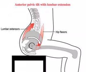 什么样的臀型最难看,什么样的臀型好看