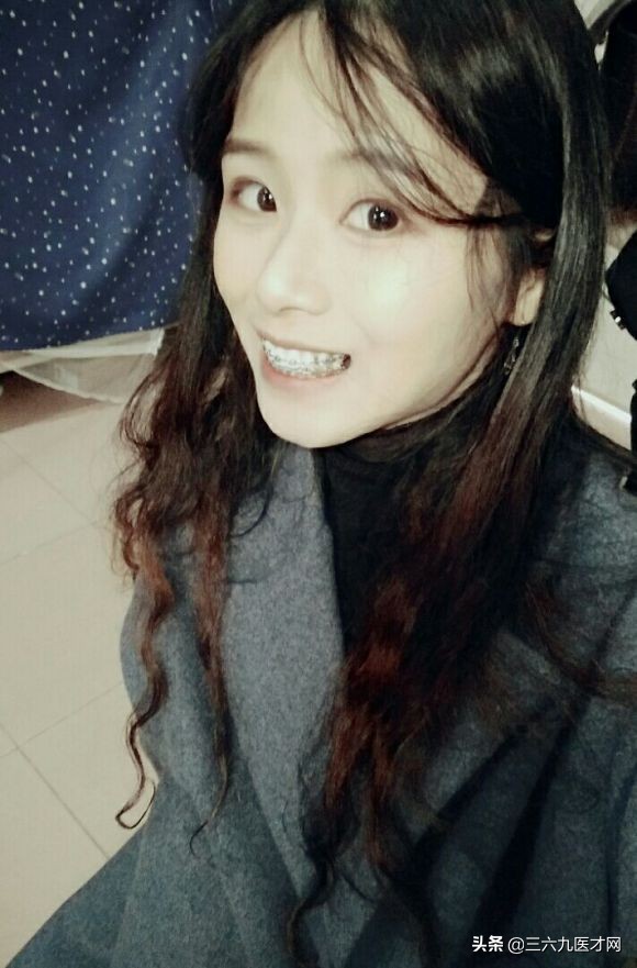 2周岁龅牙可以矫正吗,微龅牙整完后悔吗