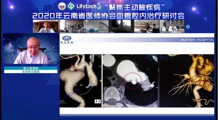 血管腔内治疗研讨会,主动脉疾病治疗研讨班