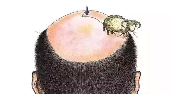 贾平凹的秃头文章,贾平凹秃顶的十大好处