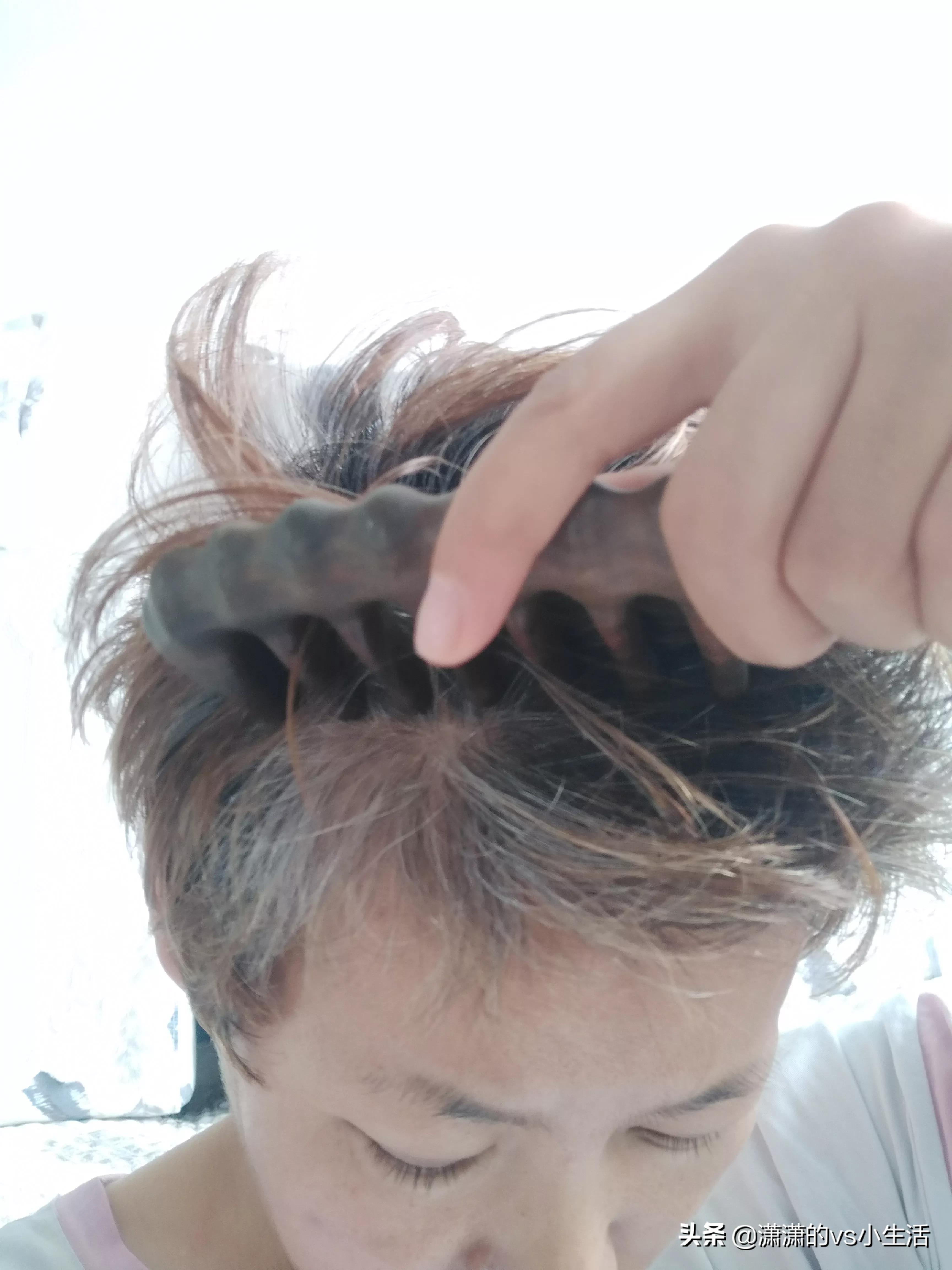 坚持用一种方法治愈白发,坚持10年改善白发