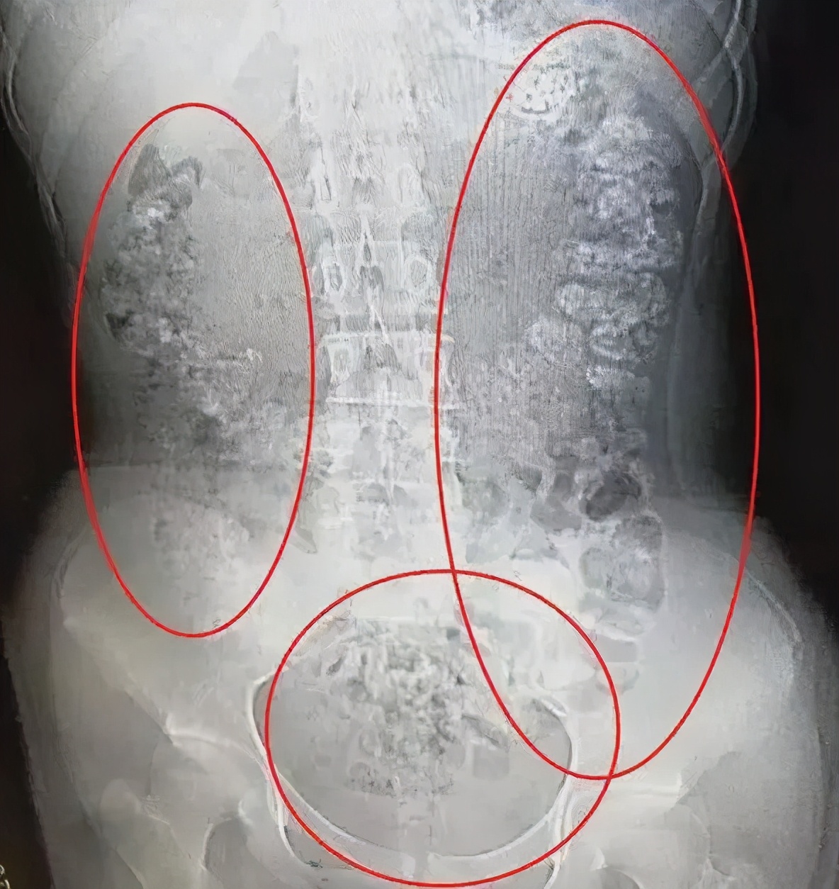奶茶禁忌你知道吗,广东奶茶喝出问题