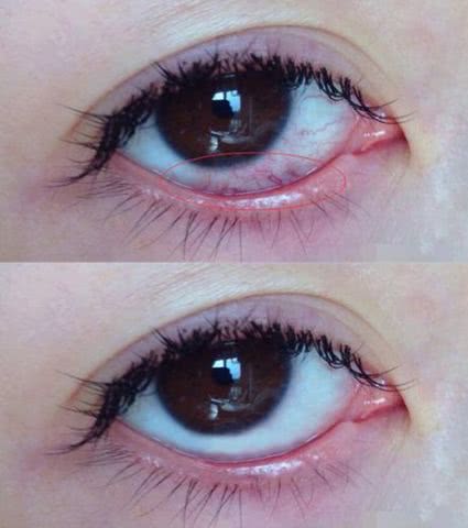 淡斑祛痘印什么产品最有效,淡斑美白祛痘印