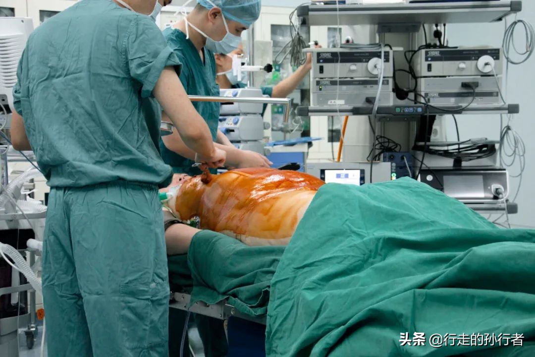 切胃减肥手术的副作用,为了减肥切胃到底值不值