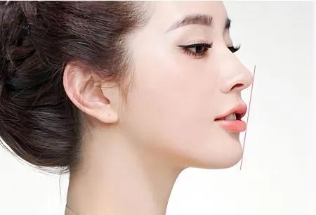 下巴出来了脸型会变好看吗,下巴对颜值有多重要呢
