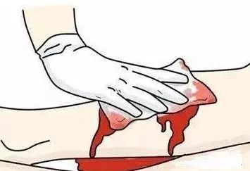 icu升压药物维持多久,icu常用药物汇总ppt