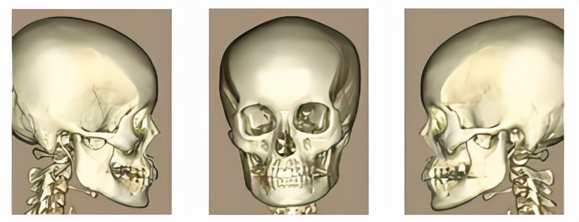 国字脸改变脸型方法,国字脸男怎么能使脸变尖