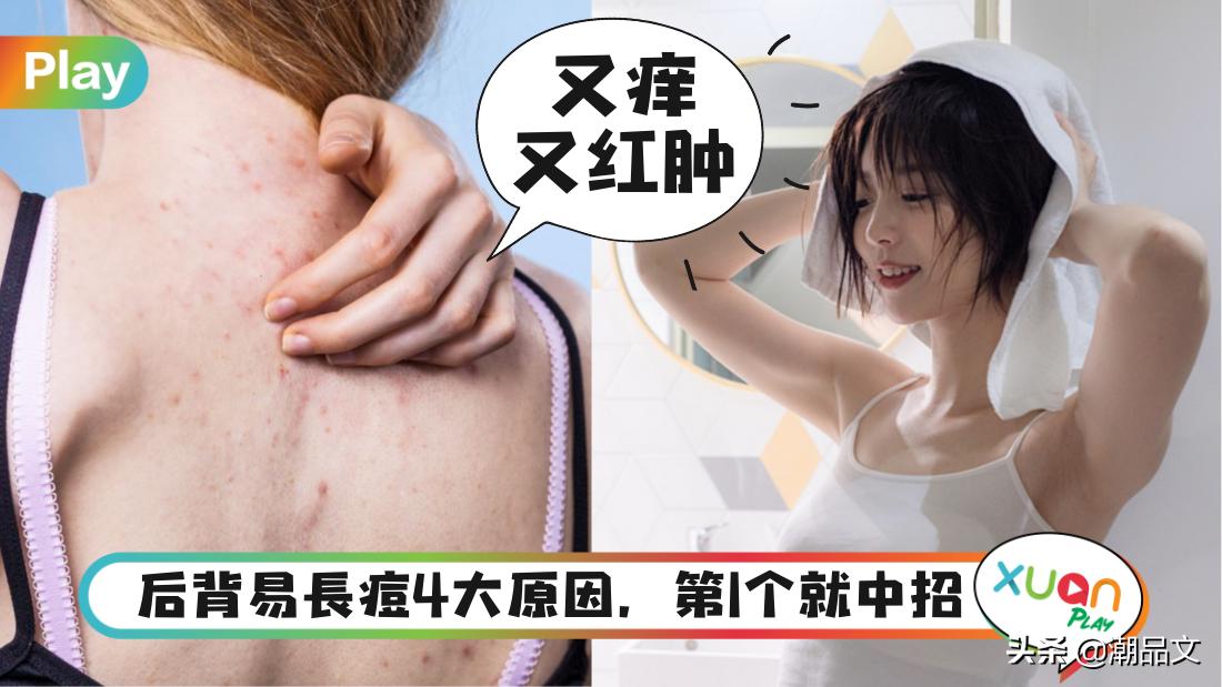 大红痘痘怎么快速消除后背,热天后背长痘痘的原因和解决方法