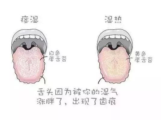 妇科炎症吃什么药治湿热,脾胃虚寒妇科炎症怎么用药