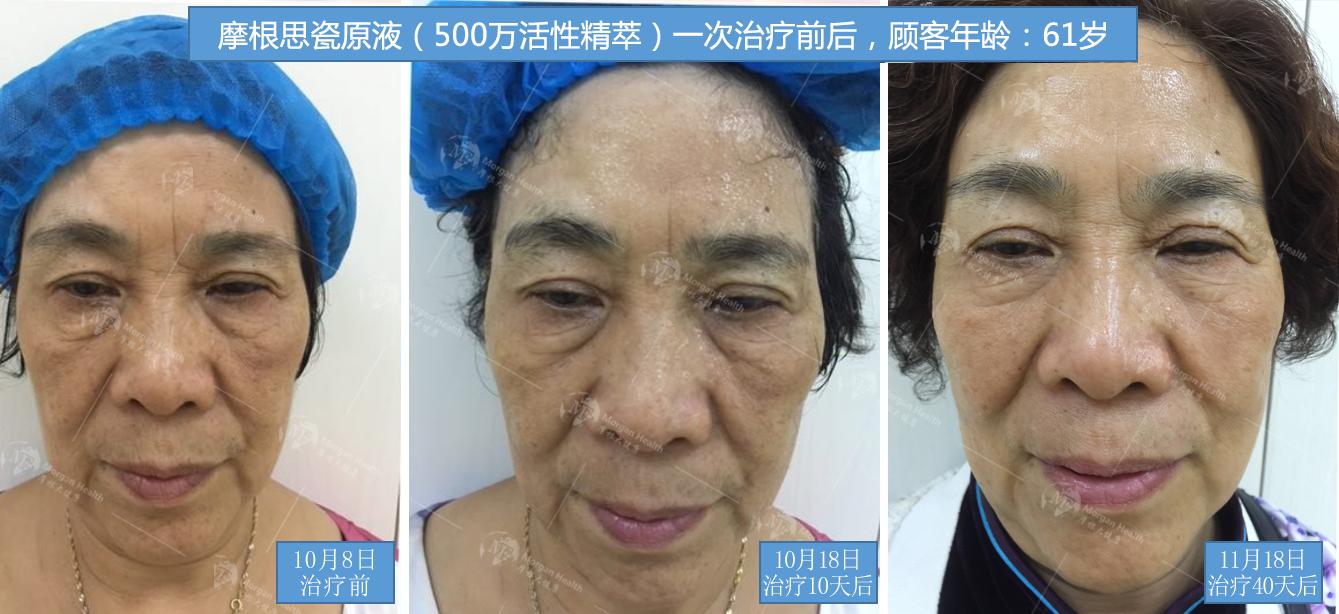 自然疗愈与觉醒,自然疗愈塑造健康理念