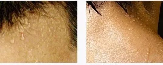 治脚冷的最有效偏方,老中医教你脚暖