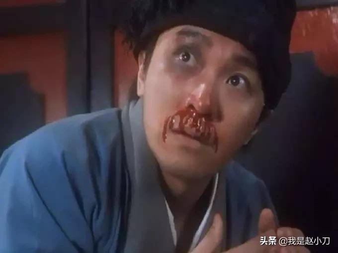 眼外伤急救演练流程,眼外伤急救处理原则