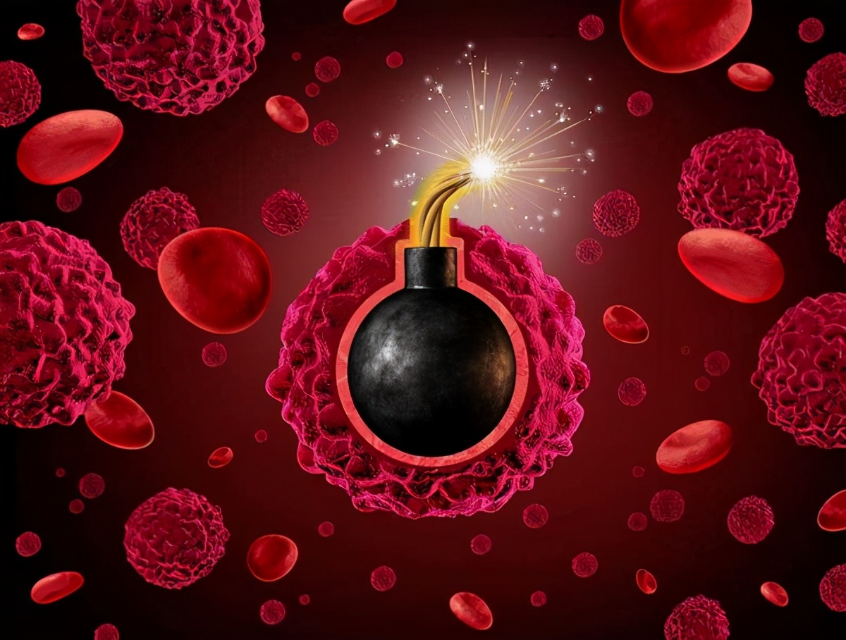 肿瘤有十大警告信号,肿瘤可能突然感觉到吗