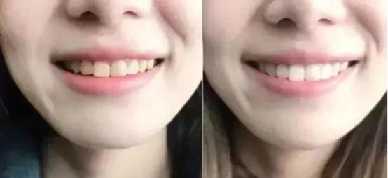 杨颖和姚晨演技,姚晨和杨颖谁的嘴巴大