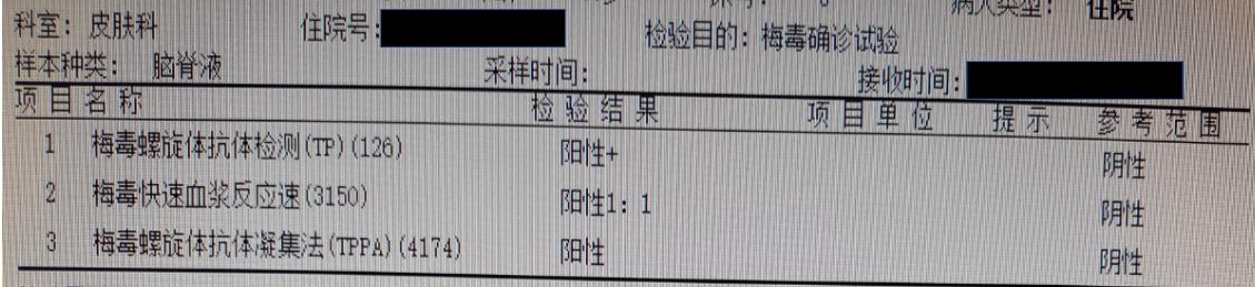 梅毒头疼是神经梅毒吗,神经性梅毒会导致头疼吗