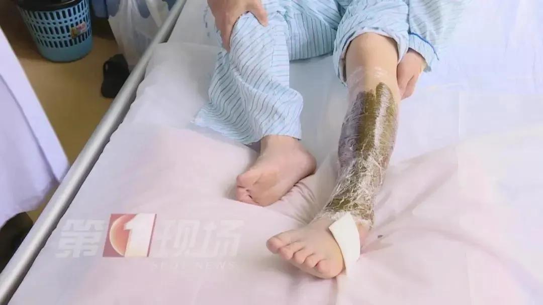 深圳毒蛇分布 (毒蛇高发地区)