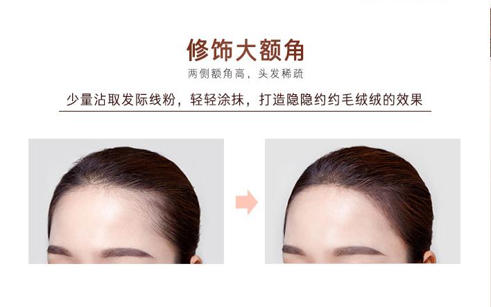 发际线成颜值杀手？杨幂宋茜都扛不住要植发，程潇王鸥却轻松挽救